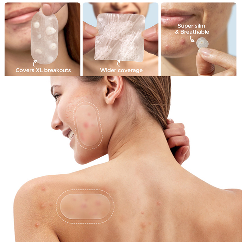 Beauty Makeup Remover - New 116Pcs Invisible Anti-Acne Repair Patches