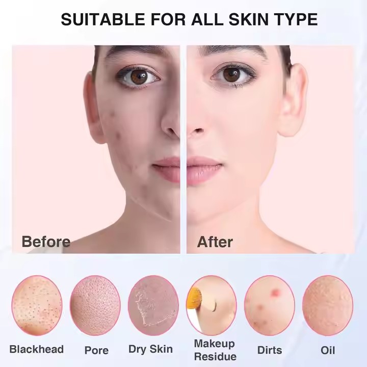 Sonic Waterproof Facial Cleans - Electric Face Cleanser Brush avis et prix