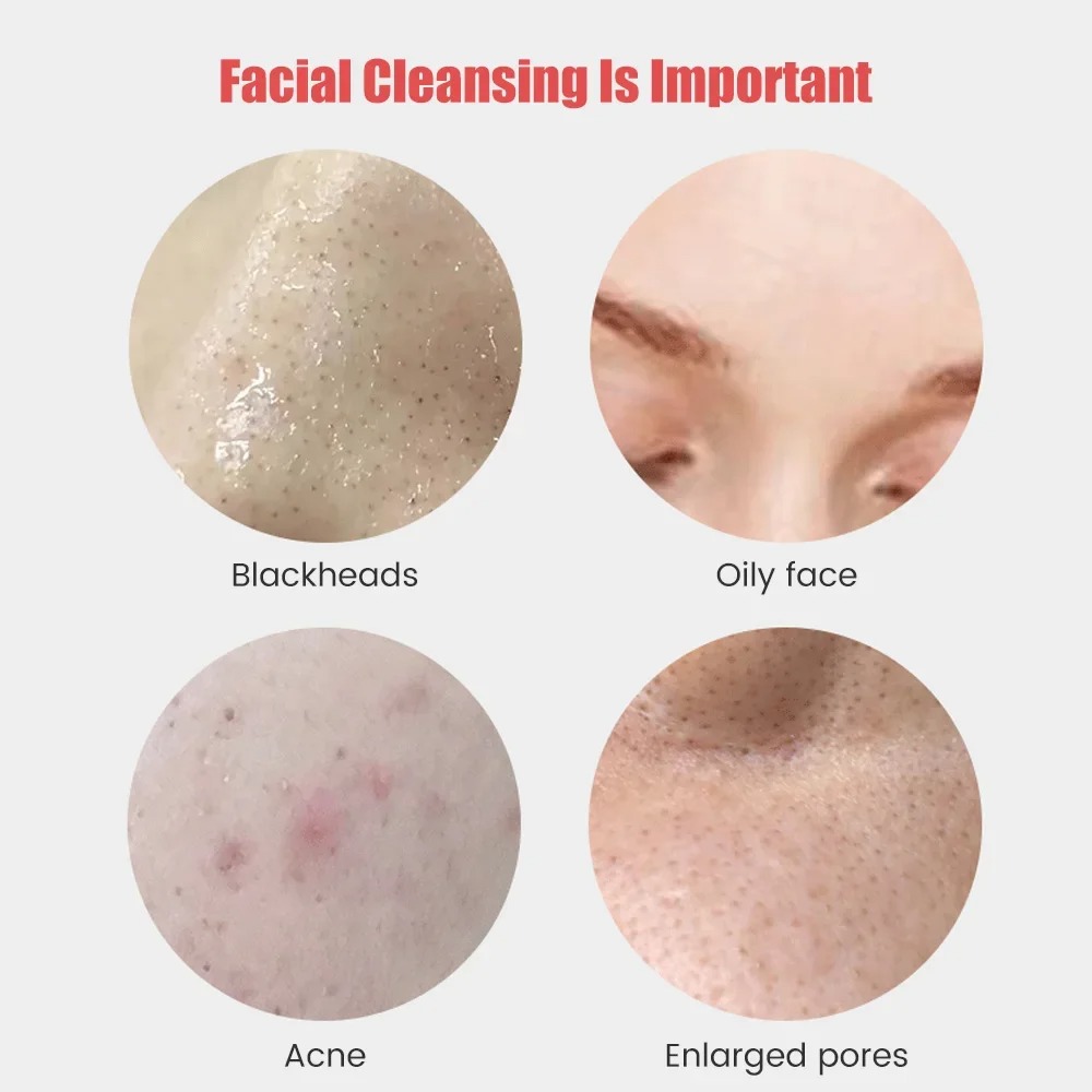 Ultrasonic Vibration Cleanser  - Electric Face Cleanser Brush avis et prix