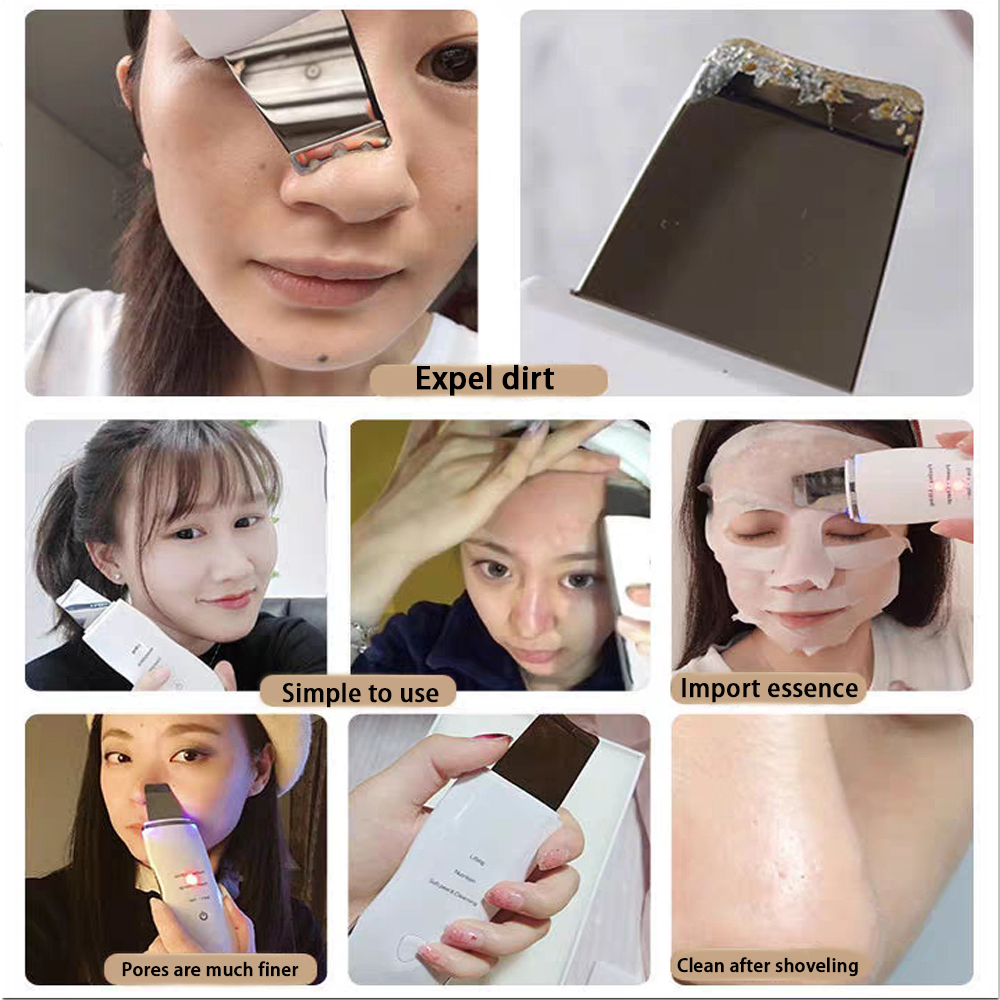 Electric Skin Scrubber Peeling - Electric Face Cleanser Brush avis et prix