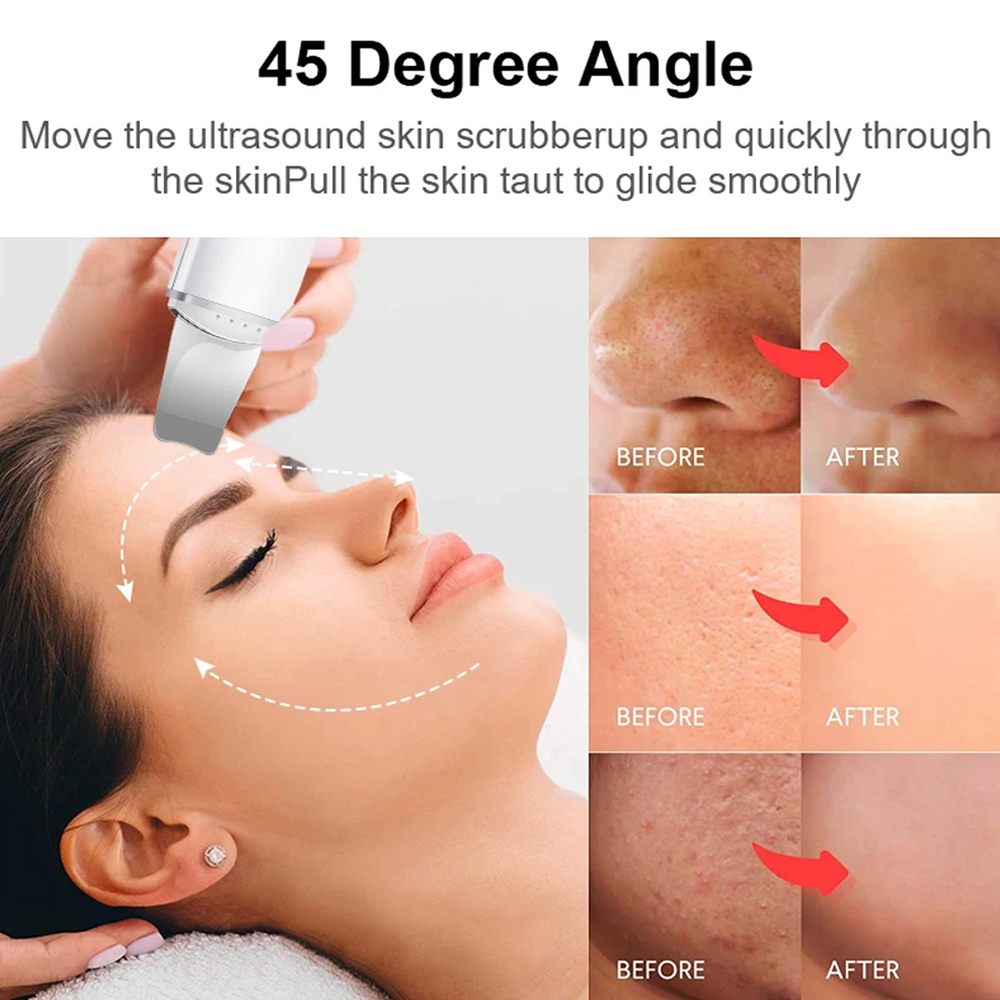 Electric Skin Scrubber Peeling - Electric Face Cleanser Brush avis et prix